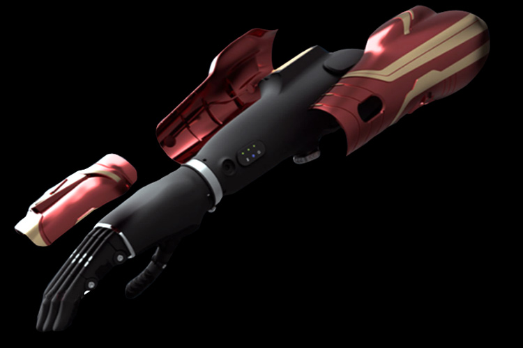 Bionic Technology - The Future of Prosthetics Bionic Technology - The Future of Prosthetics