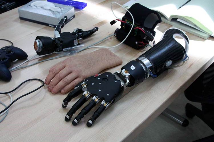 Prosthetic Devices Prosthetic Devices