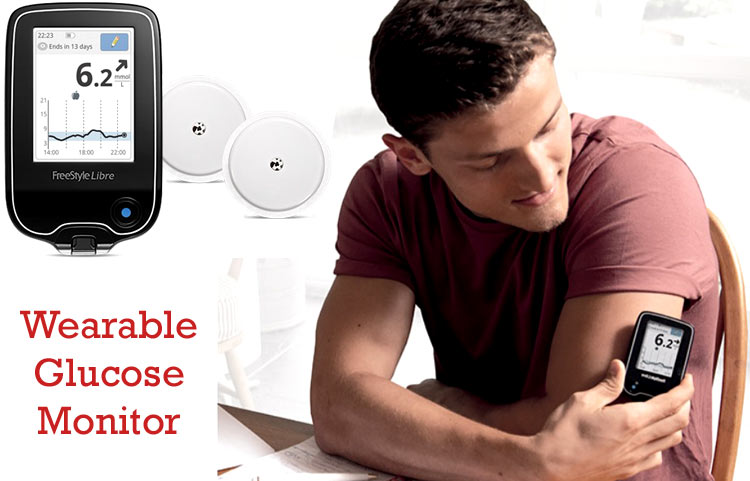 Smart Wearable Glucose Monitoring Device Wearable glucose monitoring device for diabetic patients