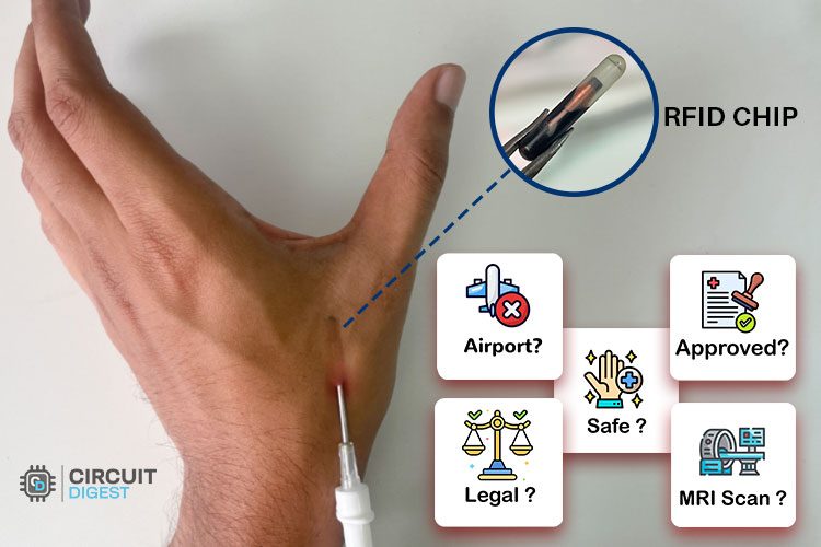 RFID Chip Implant RFID Chip Implant
