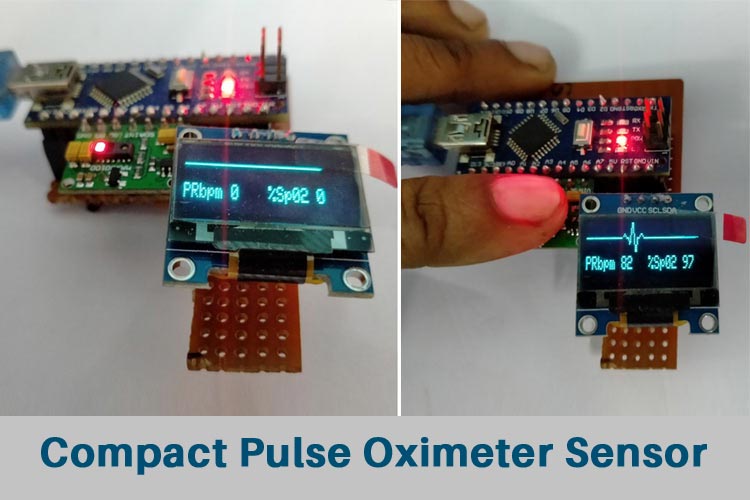 Arduino Based Pulse Oximeter Sensor Arduino Based Pulse Oximeter Sensor Circuit