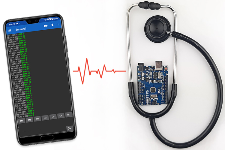 Digital Wireless Stethoscope with Bluetooth Digital Wireless Stethoscope with Bluetooth