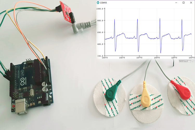 AD8232 ECG sensor with Arduino AD8232 ECG sensor with Arduino
