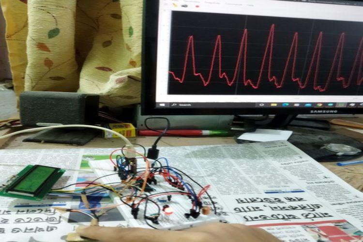Heart Rate and Body Temperature Monitoring System using ATmega328 Microcontroller Heart Rate and Body Temperature Monitoring System using ATmega328 Microcontroller