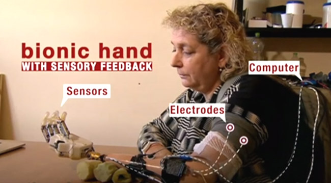 Bionic Hand with Sense of Touch Bionic Hand with Sense of Touch