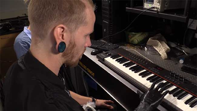 Bionic Hand Enables Amputees Control Individual Prosthetic Fingers and Play Piano Bionic Hand Enables Amputees Control Individual Prosthetic Fingers and Play Piano