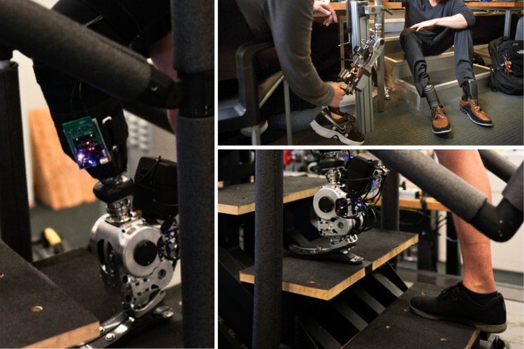 Neural Feedback Technology Restores Natural Walking for Amputees Neural Feedback Technology Restores Natural Walking for Amputees