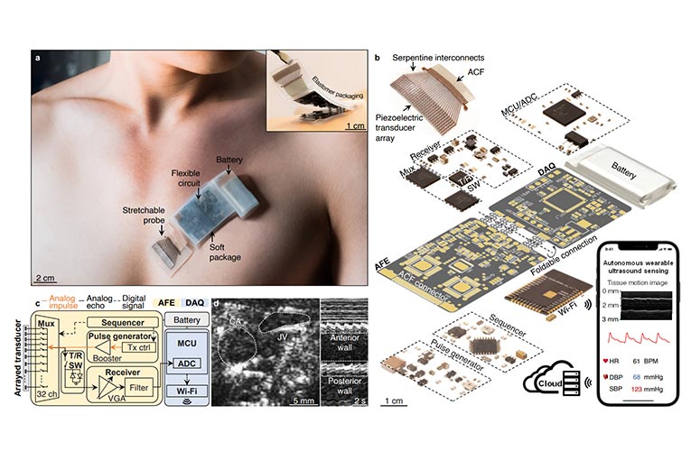 Wearable Ultrasound System Wearable Ultrasound System