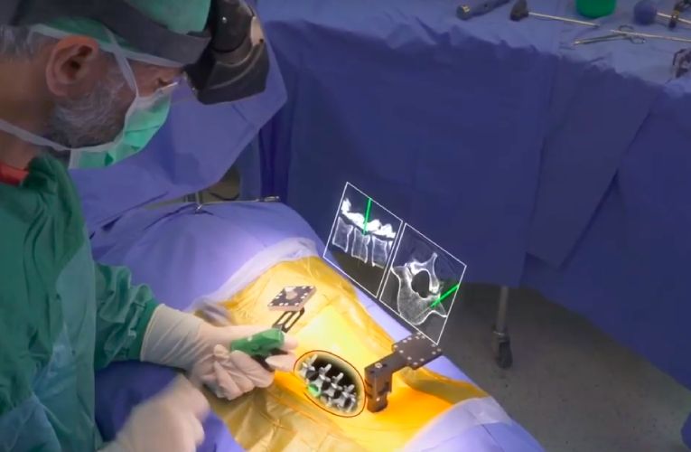 Xvision Spine – FDA Approved Augmented Reality Surgical Guidance System Xvision Spine – FDA Approved Augmented Reality Surgical Guidance System