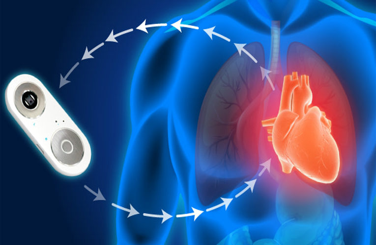 iCare Cardiovascular Tester iCare Cardiovascular Tester